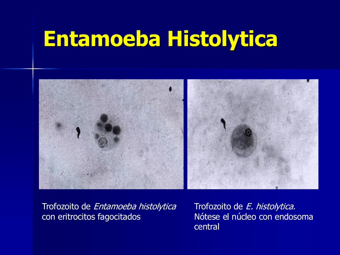 # Protozoarios
100 μm # Protozoarios
■ Son unicelulares pertenecientes al Reino Protista,
subreino Protozoa.
* Eucariotas, microscopico