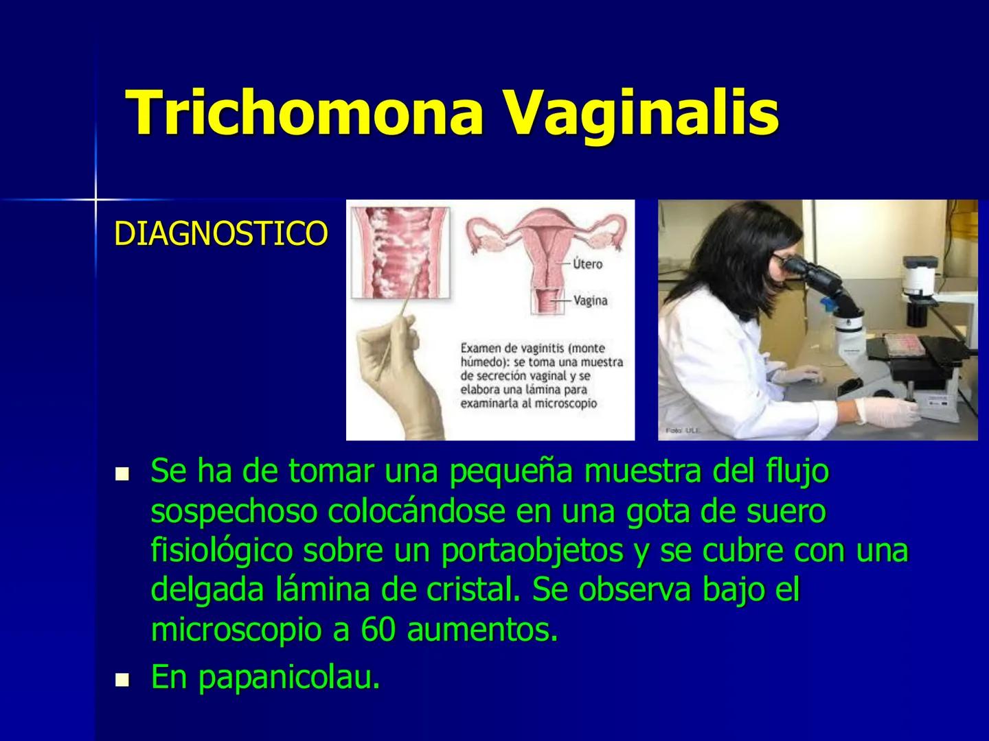# Protozoarios
100 μm # Protozoarios
■ Son unicelulares pertenecientes al Reino Protista,
subreino Protozoa.
* Eucariotas, microscopico