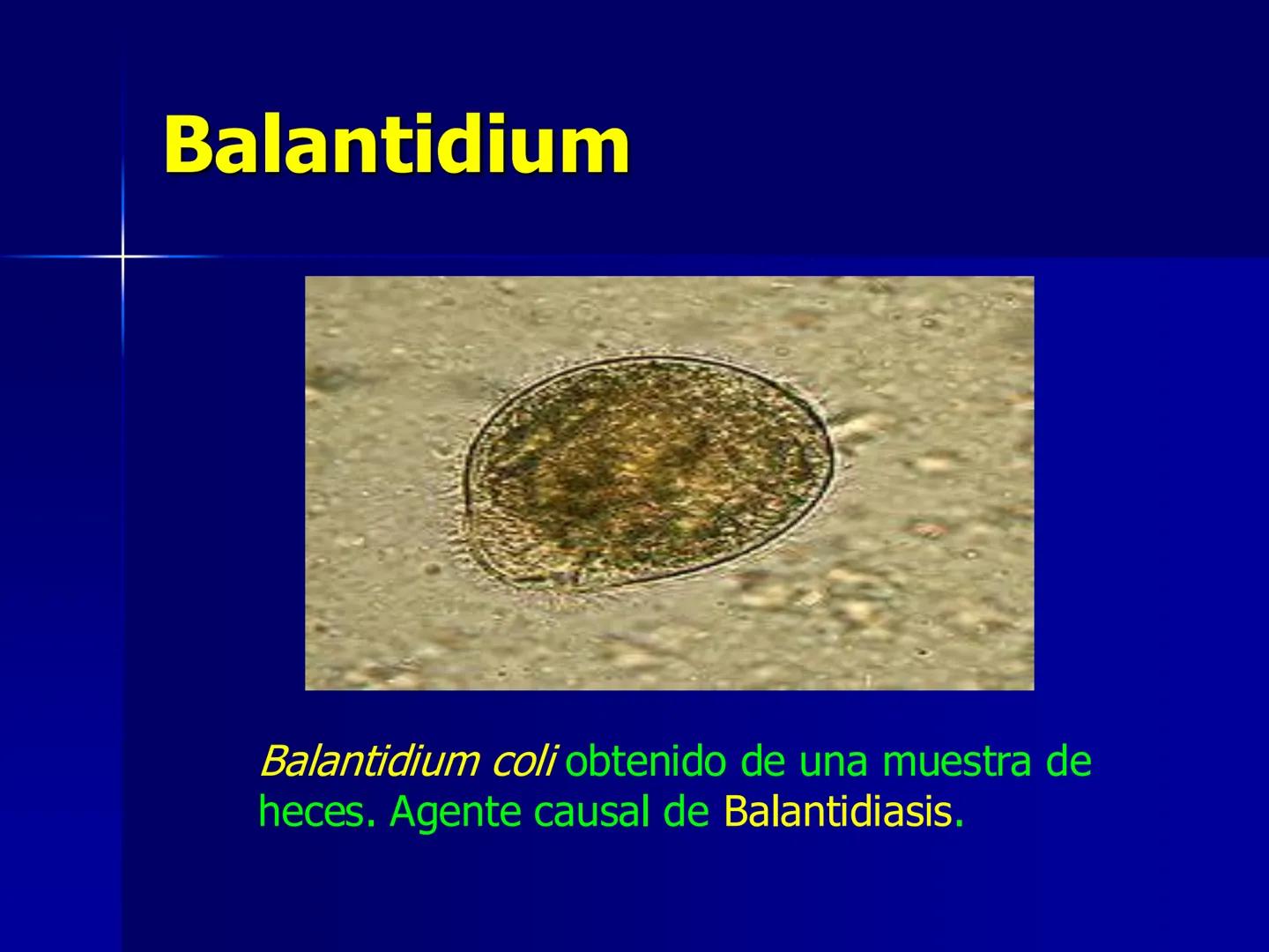 # Protozoarios
100 μm # Protozoarios
■ Son unicelulares pertenecientes al Reino Protista,
subreino Protozoa.
* Eucariotas, microscopico