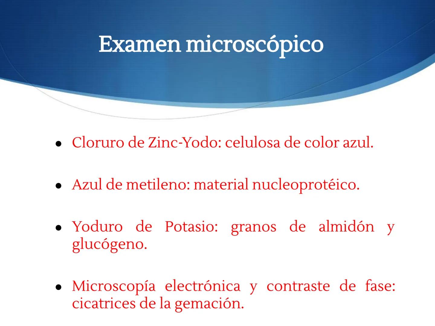 HONGOS
GENERALIDADES DE LOS HONGOS.
MORFOLOGÍA DE LOS HONGOS.
CLASIFICACIÓN DE LOS HONGOS.
NUTRICIÓN Y FISIOLOGÍA DE LOS HONGOS.
REPRODUCCIÓ