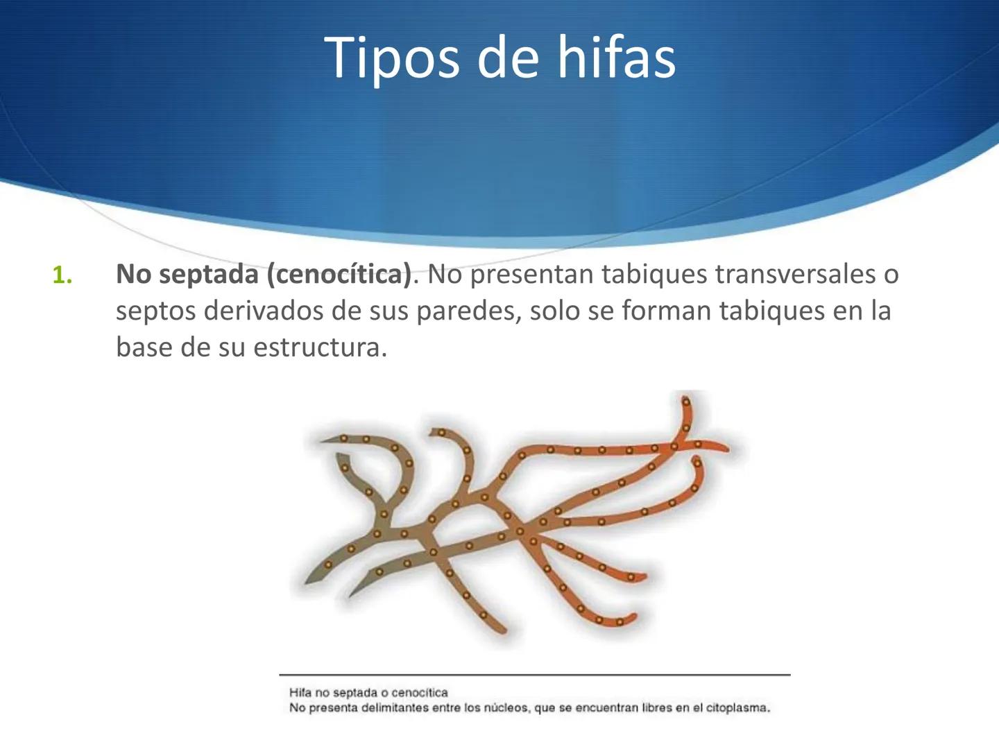 HONGOS
GENERALIDADES DE LOS HONGOS.
MORFOLOGÍA DE LOS HONGOS.
CLASIFICACIÓN DE LOS HONGOS.
NUTRICIÓN Y FISIOLOGÍA DE LOS HONGOS.
REPRODUCCIÓ