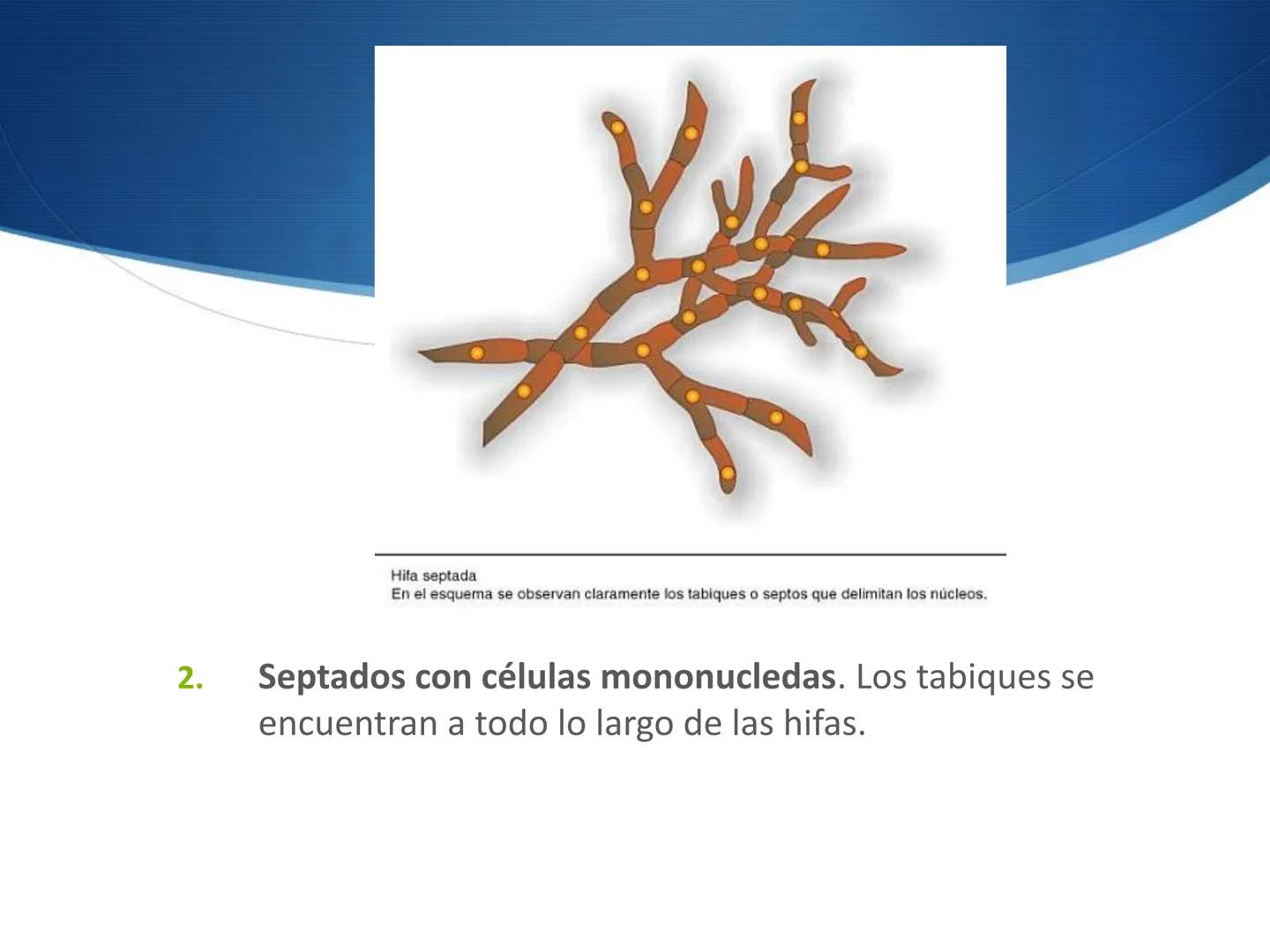 HONGOS
GENERALIDADES DE LOS HONGOS.
MORFOLOGÍA DE LOS HONGOS.
CLASIFICACIÓN DE LOS HONGOS.
NUTRICIÓN Y FISIOLOGÍA DE LOS HONGOS.
REPRODUCCIÓ