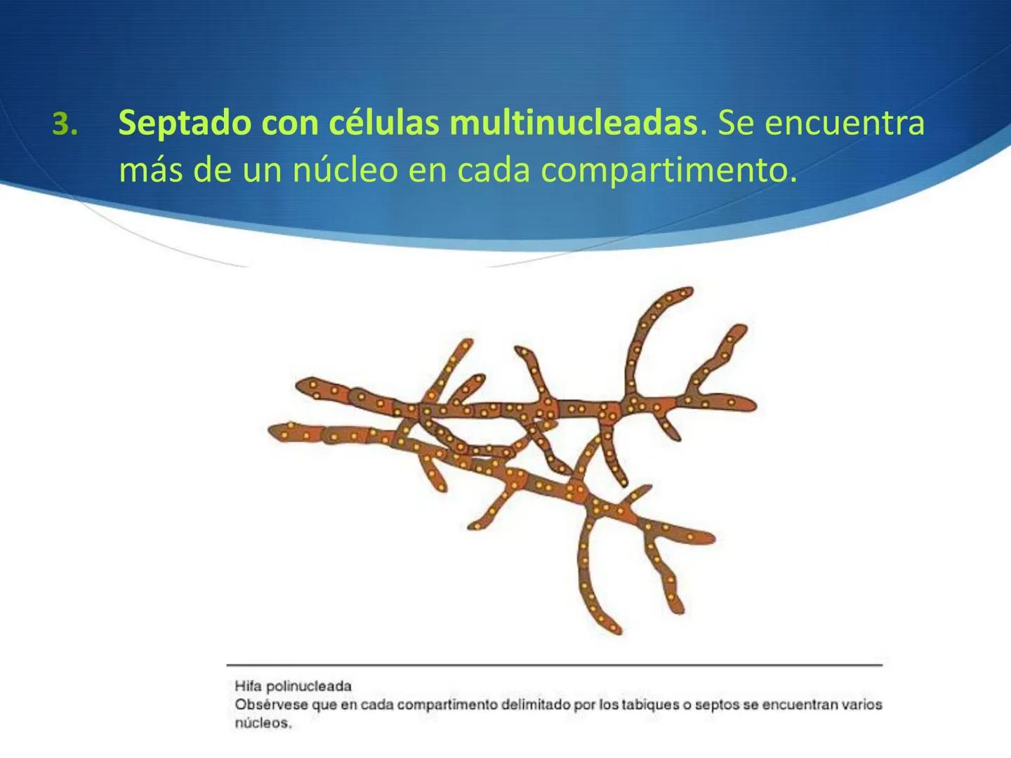 HONGOS
GENERALIDADES DE LOS HONGOS.
MORFOLOGÍA DE LOS HONGOS.
CLASIFICACIÓN DE LOS HONGOS.
NUTRICIÓN Y FISIOLOGÍA DE LOS HONGOS.
REPRODUCCIÓ