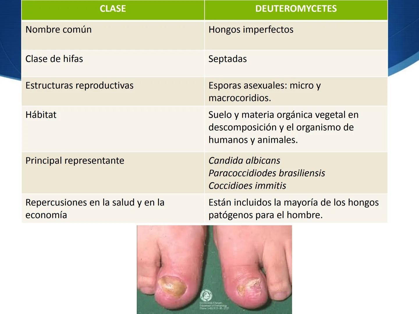 HONGOS
GENERALIDADES DE LOS HONGOS.
MORFOLOGÍA DE LOS HONGOS.
CLASIFICACIÓN DE LOS HONGOS.
NUTRICIÓN Y FISIOLOGÍA DE LOS HONGOS.
REPRODUCCIÓ