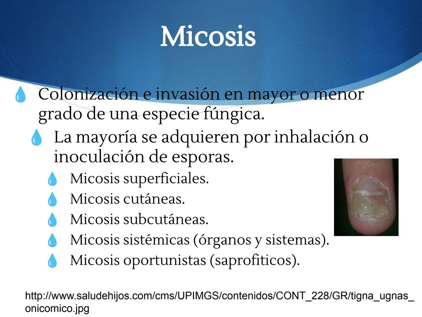 HONGOS
GENERALIDADES DE LOS HONGOS.
MORFOLOGÍA DE LOS HONGOS.
CLASIFICACIÓN DE LOS HONGOS.
NUTRICIÓN Y FISIOLOGÍA DE LOS HONGOS.
REPRODUCCIÓ