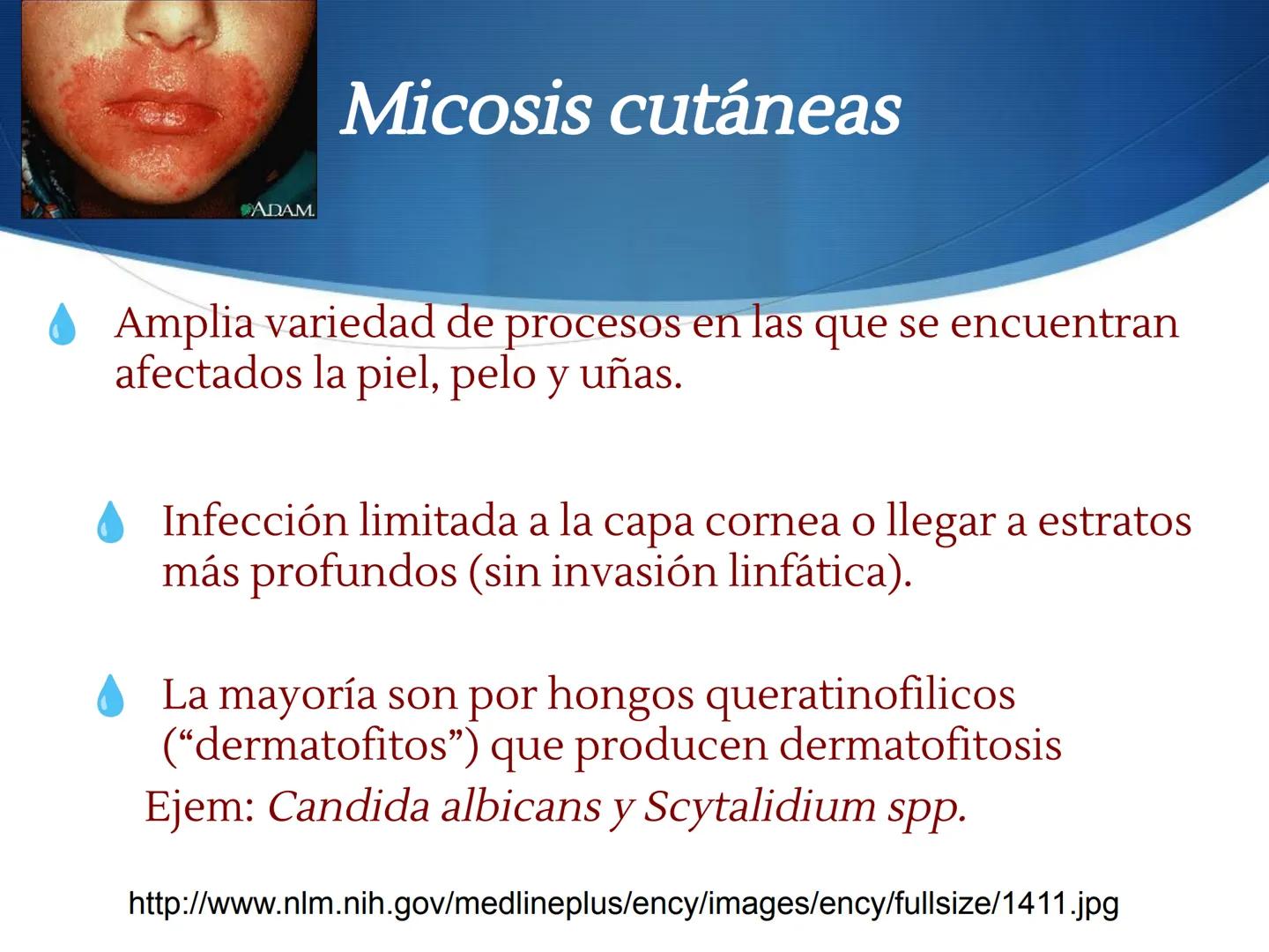 HONGOS
GENERALIDADES DE LOS HONGOS.
MORFOLOGÍA DE LOS HONGOS.
CLASIFICACIÓN DE LOS HONGOS.
NUTRICIÓN Y FISIOLOGÍA DE LOS HONGOS.
REPRODUCCIÓ