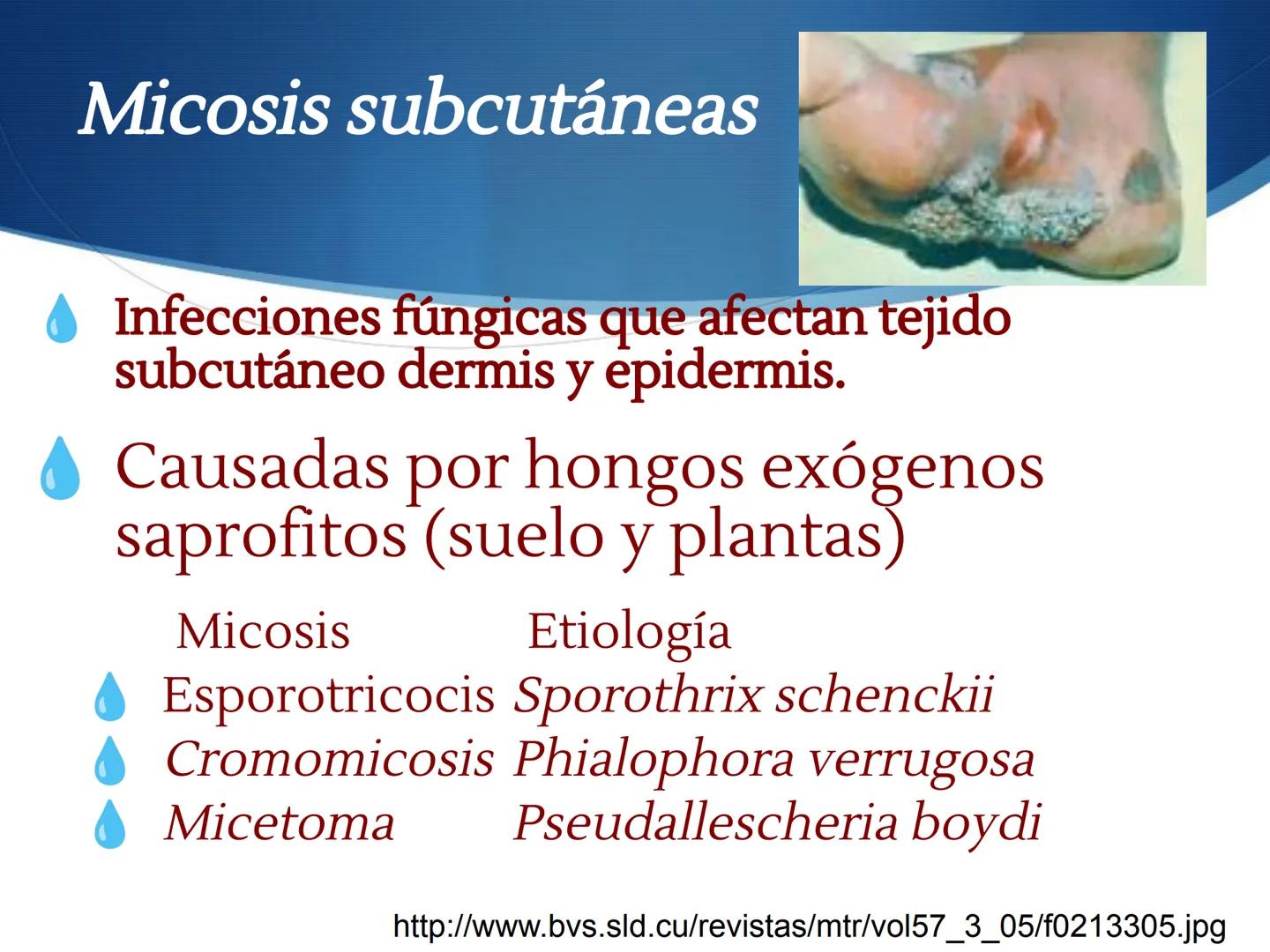 HONGOS
GENERALIDADES DE LOS HONGOS.
MORFOLOGÍA DE LOS HONGOS.
CLASIFICACIÓN DE LOS HONGOS.
NUTRICIÓN Y FISIOLOGÍA DE LOS HONGOS.
REPRODUCCIÓ
