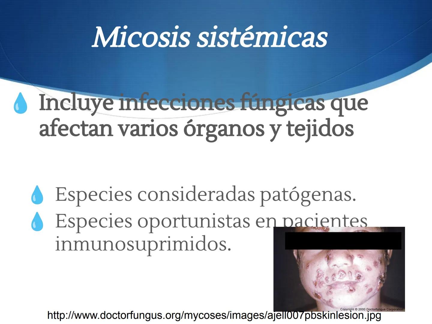 HONGOS
GENERALIDADES DE LOS HONGOS.
MORFOLOGÍA DE LOS HONGOS.
CLASIFICACIÓN DE LOS HONGOS.
NUTRICIÓN Y FISIOLOGÍA DE LOS HONGOS.
REPRODUCCIÓ