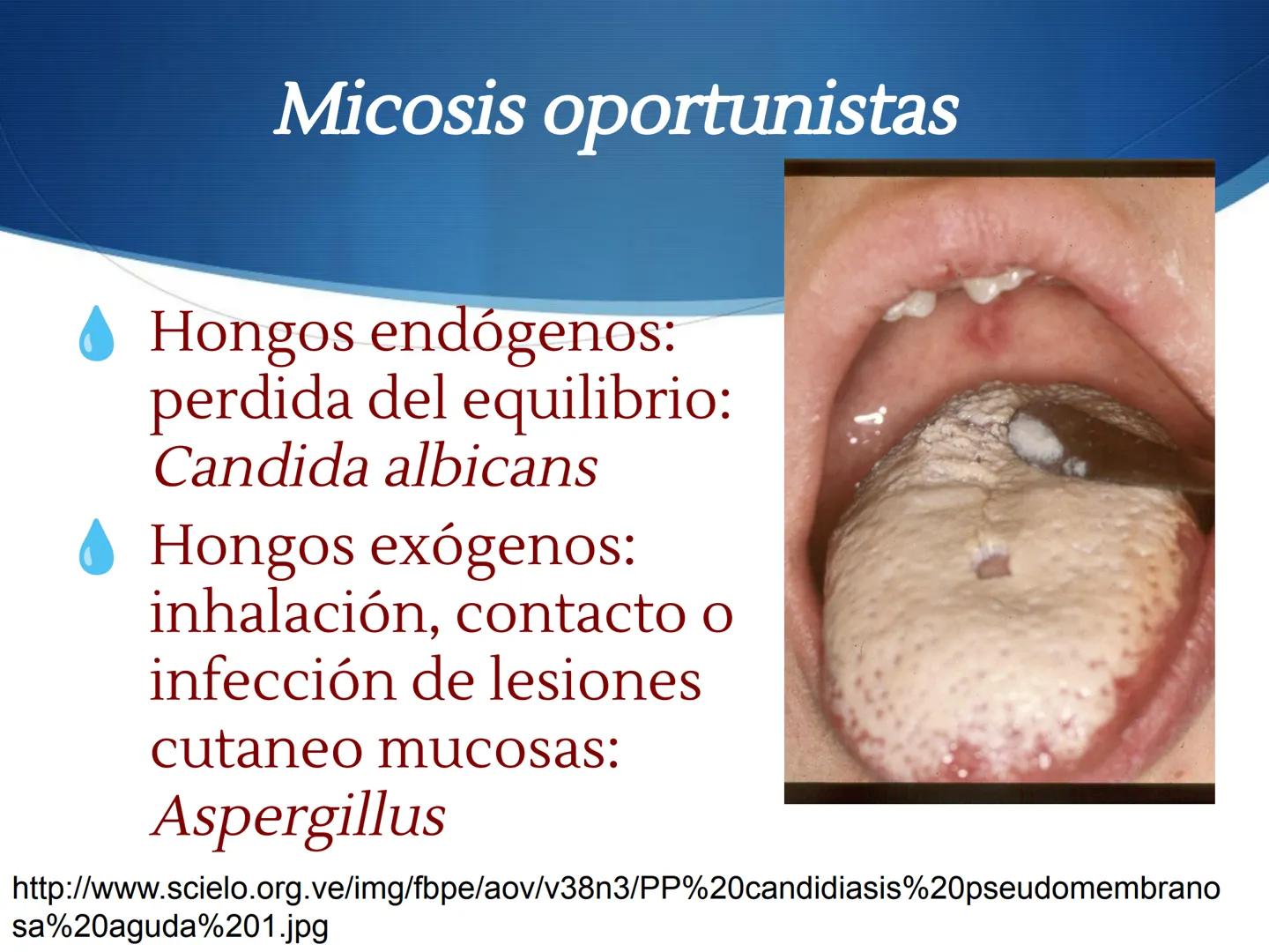 HONGOS
GENERALIDADES DE LOS HONGOS.
MORFOLOGÍA DE LOS HONGOS.
CLASIFICACIÓN DE LOS HONGOS.
NUTRICIÓN Y FISIOLOGÍA DE LOS HONGOS.
REPRODUCCIÓ
