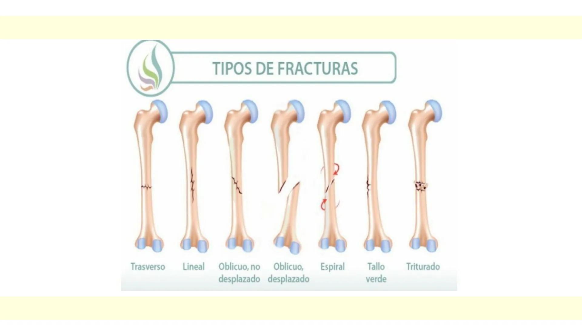 # SISTEMA ÓSEO Es una compleja estructura compuesta por los huesos del
esqueleto humano, los cartílagos, los ligamentos y
los tendones.
Cad