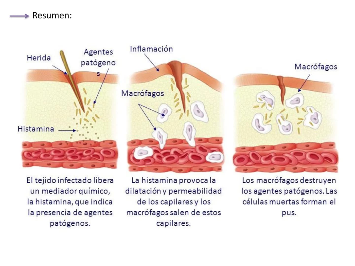# Qué vamos a estudiar...
## 1. EL SISTEMA INMUNE
### 1.1. La inmunidad y la respuesta inmune
## 2. EL SISTEMA INMUNITARIO INNATO
### 2.1. R