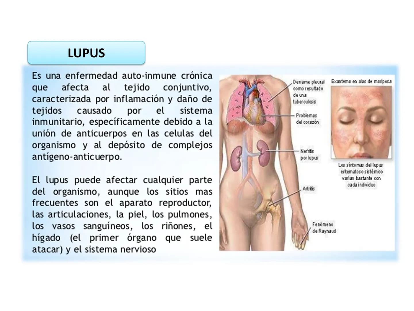 # Qué vamos a estudiar...
## 1. EL SISTEMA INMUNE
### 1.1. La inmunidad y la respuesta inmune
## 2. EL SISTEMA INMUNITARIO INNATO
### 2.1. R