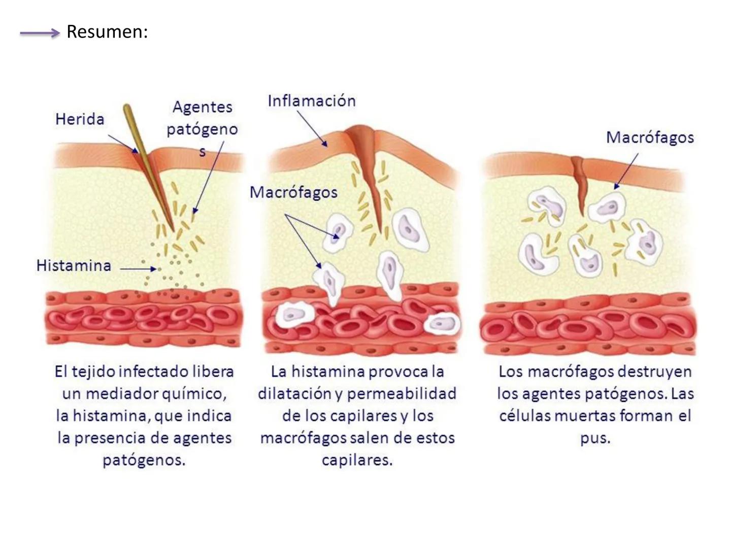 Qué vamos a estudiar...
1. EL SISTEMA INMUNE
1.1. La inmunidad y la respuesta inmune
2. EL SISTEMA INMUNITARIO INNATO
2.1. Respuesta inflama