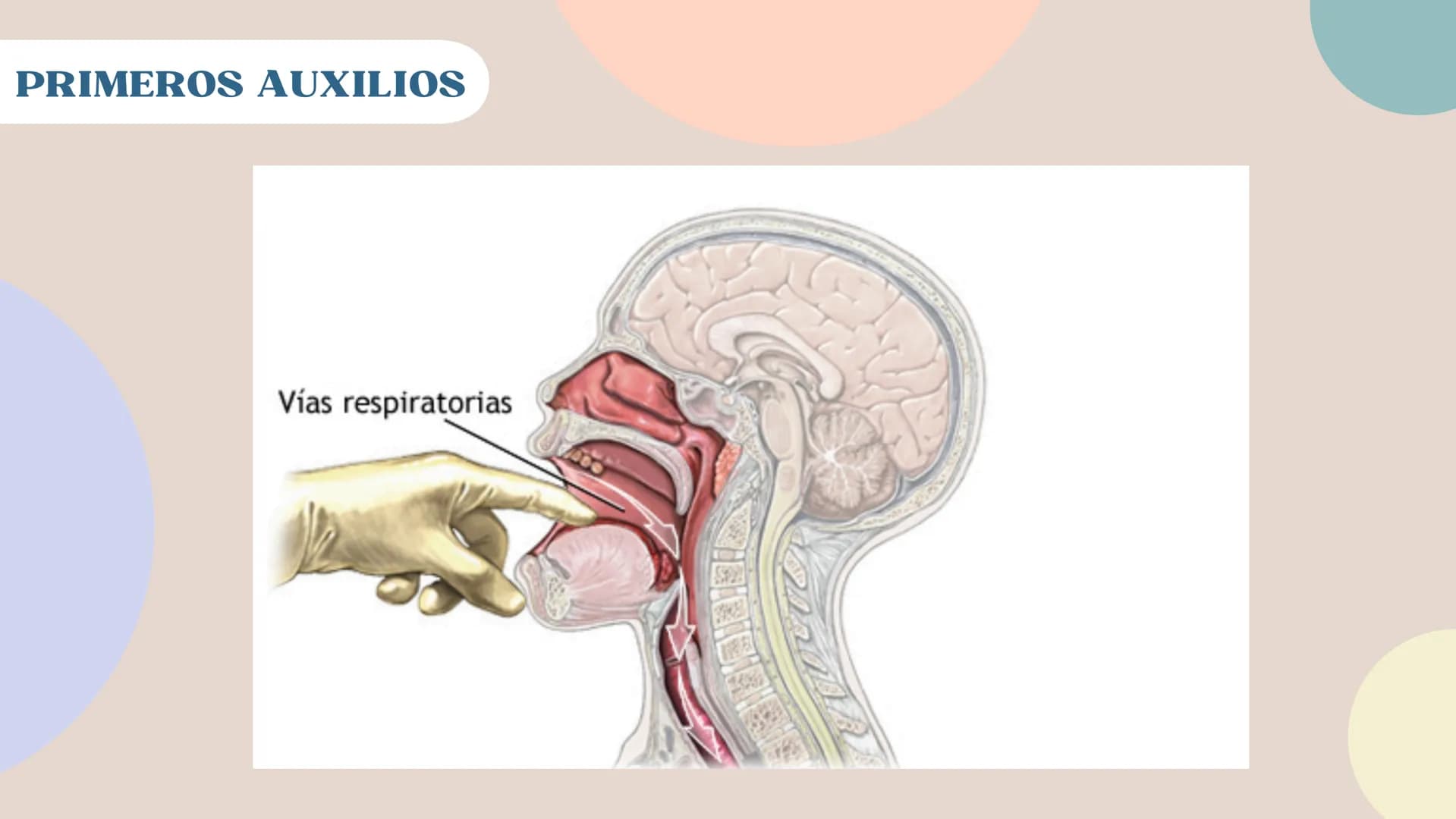 Prevención primeros auxilios ante una
INTOXICACIÓN # DEFINICIÓN
## Intoxicación
Una intoxicación es causada por la
exposición a una sustan