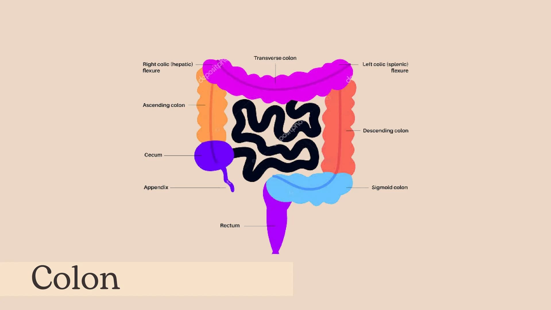 Intestino grueso, Presentación Moore – página 9